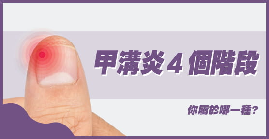 甲溝炎(凍甲)分成4個階段,你屬於哪一種?