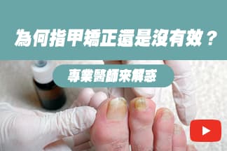 從問題趾甲到趾甲保健，照顧你的趾甲健康