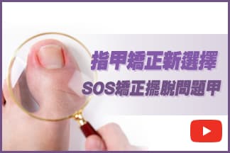 甲溝炎趾甲矯正