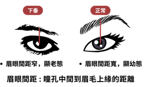 眉毛下垂