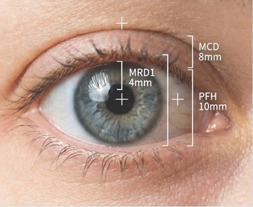 上瞼下垂 (眼皮下垂) 全面解析：病理機制、臨床診斷與現代綜合治療策略 | 維美醫學