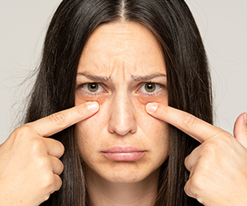 眼袋手術治療方式有哪些？5種手術幫你提亮雙眸！