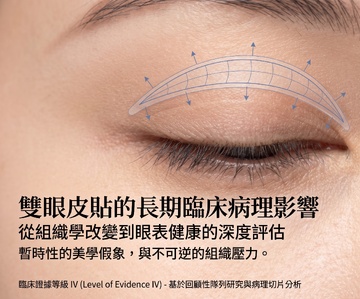 雙眼皮貼會傷眼皮嗎？4 週追蹤數據、4 種類型比較與正確貼法