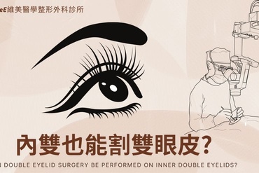 內雙能縫或割雙眼皮嗎？一篇了解內雙和外雙差別及解決三眼皮與多層雙眼皮！