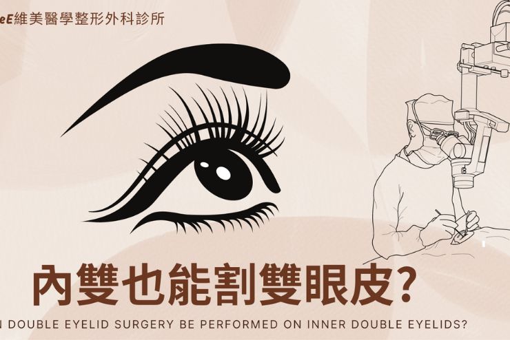 內雙能縫或割雙眼皮嗎？一篇了解內雙和外雙差別及適合手術！