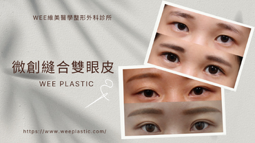 縫雙眼皮手術，無痕微創恢復期短，六大不滿意原因，更要小心線頭穿出。