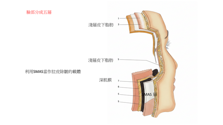 為什麼SMAS是拉皮的關鍵「載體」？