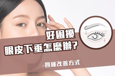 眼皮下垂眼皮鬆弛還是眼瞼肌無力? 看起來衰老無神？提眼瞼肌，修眼皮，前額拉皮三種手術性治療方式改善眼皮下垂！
