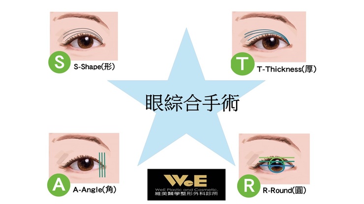 深入解析眼綜合手術：從社群趨勢到眼型分類的專業指南